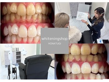 ホワイトニングショップ 本厚木店