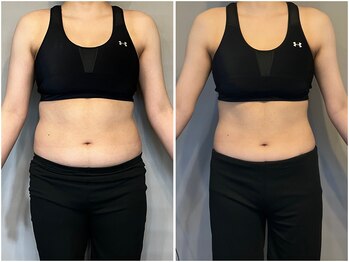 インプルーブ 浜北店(Improve)/ウエスト-10.3ｃｍ!　30代女性