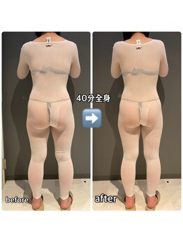 アルバ 広島店(ALBA)/エンダモロジー〈痩身ボディ〉