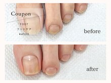 ドット シー 神戸三宮(dot c)/フットケア