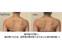 アーユス(AYUS)/リンパマッサージ・BeforeAfter