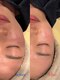 サロン カメリア(salon CAMELLIA)の写真/【毛穴洗浄】美容液で洗う！超音波ハイドロ毛穴洗浄