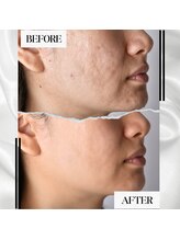 美バリ 新宿店(美BARI)/光フォトでお悩み解消