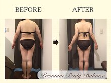 美プレミアム 川越店/１、施術結果