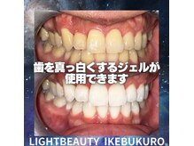 ライトビューティー 池袋店(LightBeauty)/症例写真