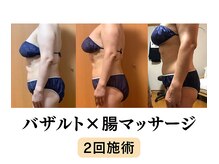 シーエスケイサロン(CSK salon)/下垂した腸を元の位置へ
