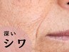 【深いシワに効く】日本初成分でピンッとハリ肌 フェイシャル(小顔リンパ付)