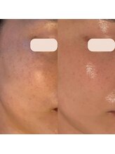 アン(An)/プラズマで回数重ねる度変化