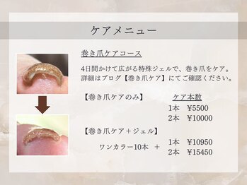 ヴァリ(Vari)/巻き爪ケアコース
