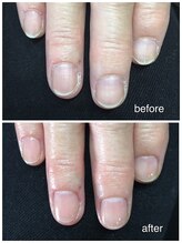 アミュレット(AMULET)/自分の手に自信がもてるケア♪