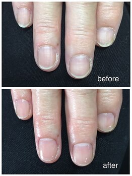 アミュレット(AMULET)/自分の手に自信がもてるケア♪