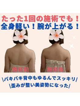 ミトラ(MITRA)/1回でも驚きの変化！