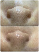 シャイニング(shining)/☆フェイシャル