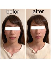 カイロプラクティック ネクサス/顔の歪み撃退☆