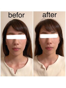 カイロプラクティック ネクサス/顔の歪み撃退☆