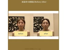 アジール 長岡リバーサイド千秋店(agir)/Before/After画像