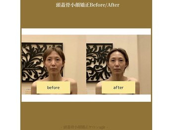 アジール 長岡リバーサイド千秋店(agir)/Before/After画像