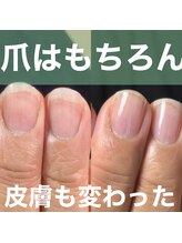 スティラ(Stila)/自爪育成/深爪育成/ジェルネイル