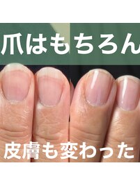 自爪育成/深爪育成/ジェルネイル