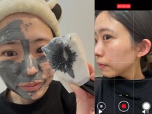 アノマリー 六本松店(Anomaly)/まずは自分の肌で実験中！