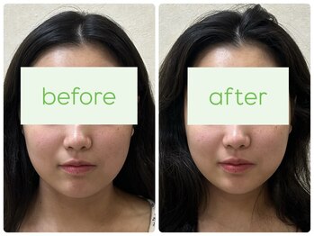 わかくさ鍼灸整体院/