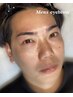 【モテ男の人気No.1】イケメン美眉とニキビケアコース¥18,000→16,900