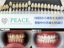 ピースドット 大村店(PEACE.)