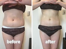 エミニーライフ(EMINY LIFE)/ダイエット3ヶ月モニター様