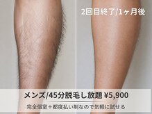 フルーブラン(Frubran)/【メンズ脱毛】45分打ち放題