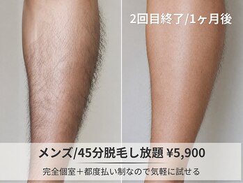 フルーブラン(Frubran)/【メンズ脱毛】45分打ち放題