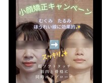 バランス整体 リスタート(Restart)
