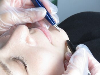 サロンロンウーマン(SALON RON woman)の写真/初めての方も安心。美容電気脱毛で硬毛化や白髪、VIOもOK!都度払いで理想の自分へ導く