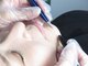 サロンロンウーマン(SALON RON woman)の写真/初めての方も安心。美容電気脱毛で硬毛化や白髪、VIOもOK!都度払いで理想の自分へ導く