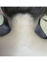 トータルビューティーサロン デザイン/光脱毛うなじ＋肩クーポン