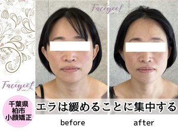 フェイシー(faceyee)/