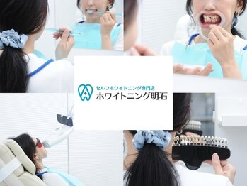 ホワイトニング明石