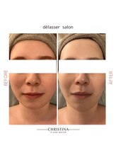 デラッセ(Delasser salon)/バリア強化保湿アンストレス