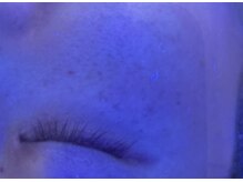 アメジスト(amethyst)/特殊ライトでシミを観察