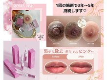 ヴィノス 京都烏丸店(vinos)の雰囲気（ローマピンク　１回の施術で完了！メラニン除去！）