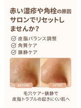 フルーヴ ルフレ(Fleuve Reflet)/毛穴ケアも刺激の少ない方法で☆