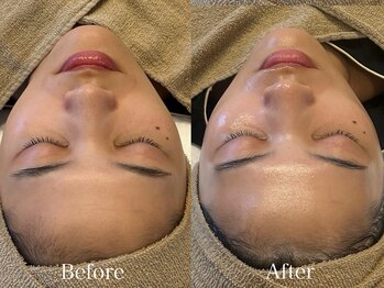 トム(Thom)/《乾燥/敏感/花粉》アンストレス