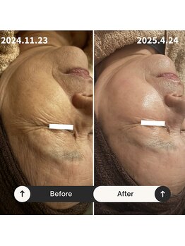 リマイン(Re mine)/70歳バースデーから始めるエステ