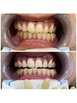 コナホワイトニング 神保町/ホワイトニング神保町