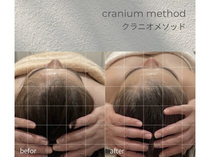 ロエン(Roen)の写真