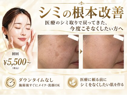 シャルナ(charna)の写真