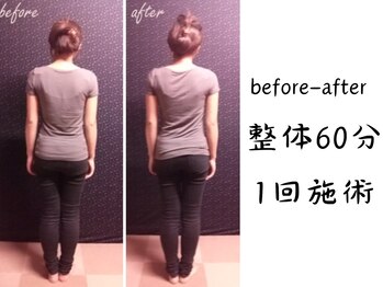 からだ庵 弘明寺本院/before-after：30代女性 施術1回