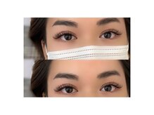 ブリンク(BLINK)/ボリューム