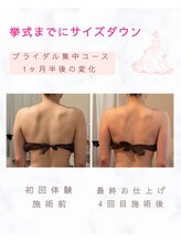 ティアラ(Tiara)/挙式までにサイズダウン