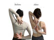 リカバリー(&recovery)/痛み軽減/辛い肩こり改善