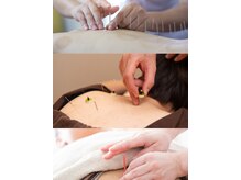 アム鍼灸ラボ 有楽町